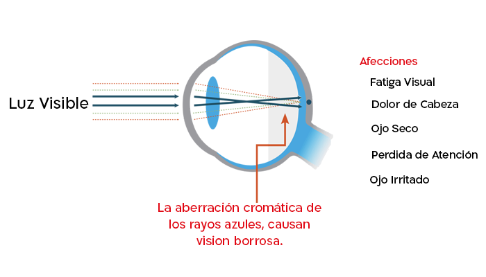 https://www.shamiruniversity.com.mx/wp-content/uploads/2021/02/Diagrama_ojo_HEV.png